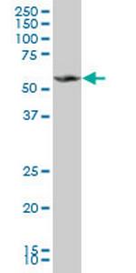 MPP1 Monoclonal Antibody (2E5)