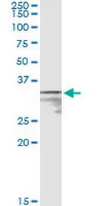 MPST Monoclonal Antibody (1B5)
