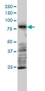 MRE11A Monoclonal Antibody (1D8-A6)