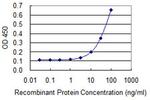 MRE11A Monoclonal Antibody (3H4-F4)