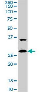 CITED1 Monoclonal Antibody (6G8)