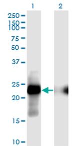 CITED1 Monoclonal Antibody (6C1)