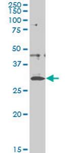 CITED1 Monoclonal Antibody (5H6)