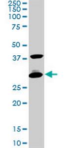 CITED1 Monoclonal Antibody (6C8)