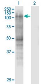 MSH2 Antibody in Western Blot (WB)