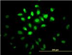 MSI1 Monoclonal Antibody (3F2)