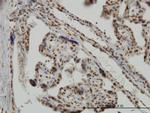 MSI1 Antibody in Immunohistochemistry (Paraffin) (IHC (P))