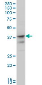 MSI1 Antibody in Western Blot (WB)