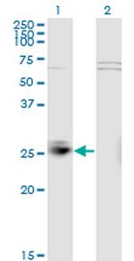 MSRA Monoclonal Antibody (3C11)