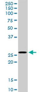 MSX1 Antibody in Western Blot (WB)