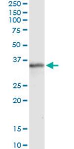 MSX1 Antibody in Immunoprecipitation (IP)