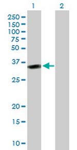 MSX2 Polyclonal Antibody, MaxPab™