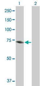 MTHFR Polyclonal Antibody, MaxPab™