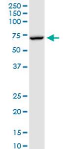 MTM1 Antibody in Western Blot (WB)