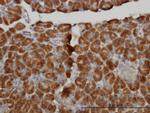 MTM1 Antibody in Immunohistochemistry (Paraffin) (IHC (P))