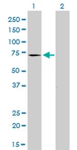 MTM1 Antibody in Western Blot (WB)