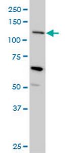 MUC4 Monoclonal Antibody (5B12)
