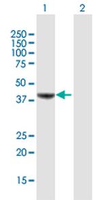 MVD Polyclonal Antibody, MaxPab™