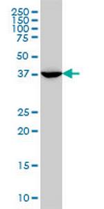 MVD Monoclonal Antibody (2A7)