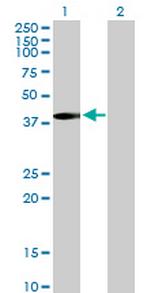 MVK Polyclonal Antibody, MaxPab™