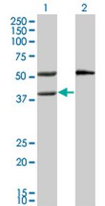 MVK Monoclonal Antibody (2C5)