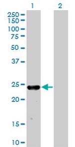 MXI1 Antibody in Western Blot (WB)