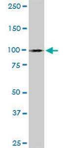 MYBL1 Monoclonal Antibody (2A2)