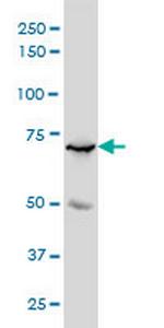 MYBL2 Monoclonal Antibody (4B4)