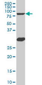 MYBL2 Monoclonal Antibody (5G5)
