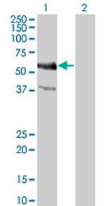 MYC Monoclonal Antibody (1G7)