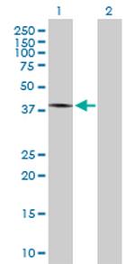 MYCN Antibody in Western Blot (WB)