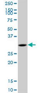 MYD88 Polyclonal Antibody, MaxPab™