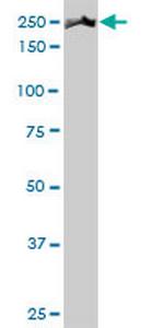 MYH9 Antibody in Western Blot (WB)