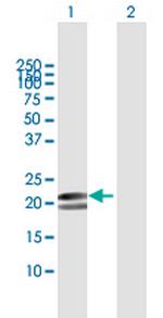 MYL1 Polyclonal Antibody, MaxPab™