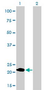 MYL1 Monoclonal Antibody (2D9)