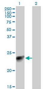 MYL3 Monoclonal Antibody (4C2)