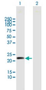 MYL5 Polyclonal Antibody, MaxPab™
