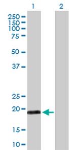 MYL5 Polyclonal Antibody, MaxPab™