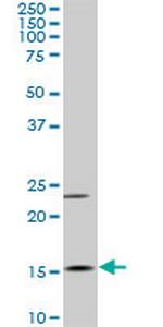MYL6 Monoclonal Antibody (1D6)