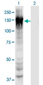 MYO1E Monoclonal Antibody (7A5)