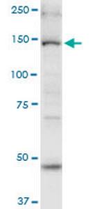 MYO6 Monoclonal Antibody (2E12)