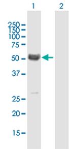 MYOC Polyclonal Antibody, MaxPab™
