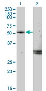 MYOC Monoclonal Antibody (2B4)