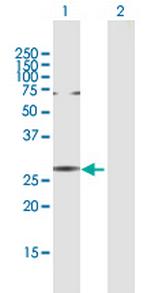 NAB2 Antibody in Western Blot (WB)