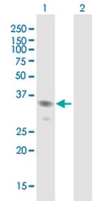 NACA Antibody in Western Blot (WB)
