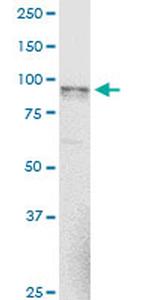 NAGLU Monoclonal Antibody (1B7)