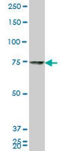 HNRPM Monoclonal Antibody (2B6)