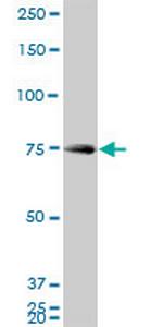 HNRPM Monoclonal Antibody (3F7)