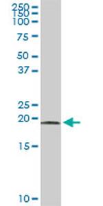 NBL1 Antibody in Western Blot (WB)