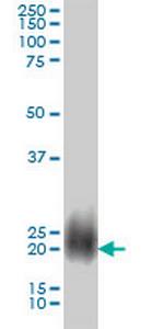 NBL1 Monoclonal Antibody (2G4)